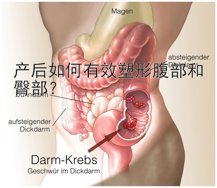 产后如何有效塑形腹部和臀部？