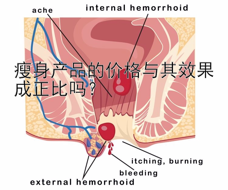 瘦身产品的价格与其效果成正比吗？