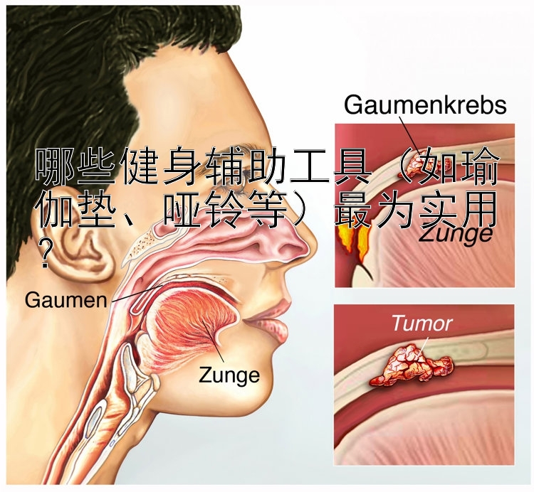 哪些健身辅助工具（如瑜伽垫、哑铃等）最为实用？