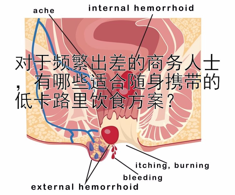 对于频繁出差的商务人士，有哪些适合随身携带的低卡路里饮食方案？