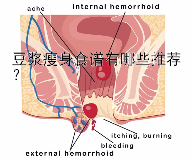 豆浆瘦身食谱有哪些推荐？