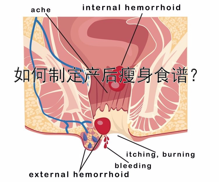 如何制定产后瘦身食谱？