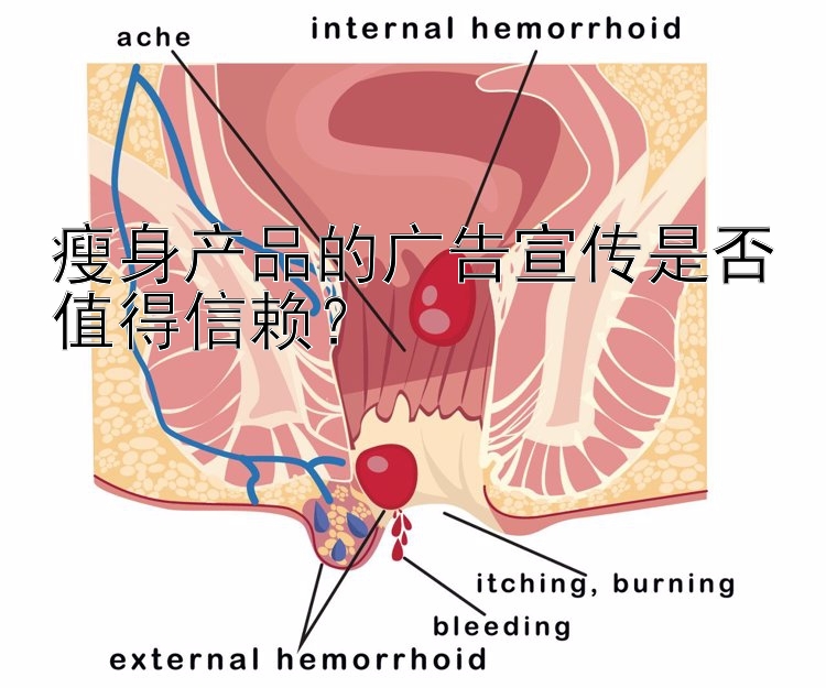 瘦身产品的广告宣传是否值得信赖？