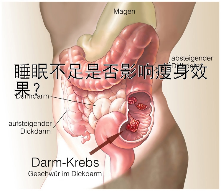 睡眠不足是否影响瘦身效果？