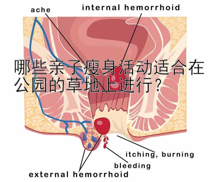 哪些亲子瘦身活动适合在公园的草地上进行？