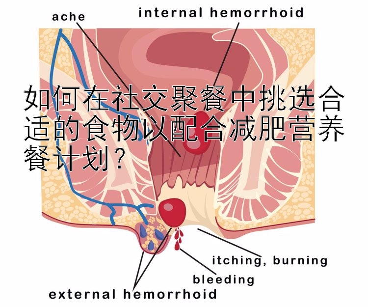 如何在社交聚餐中挑选合适的食物以配合减肥营养餐计划？