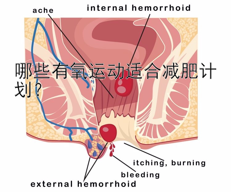 哪些有氧运动适合减肥计划？