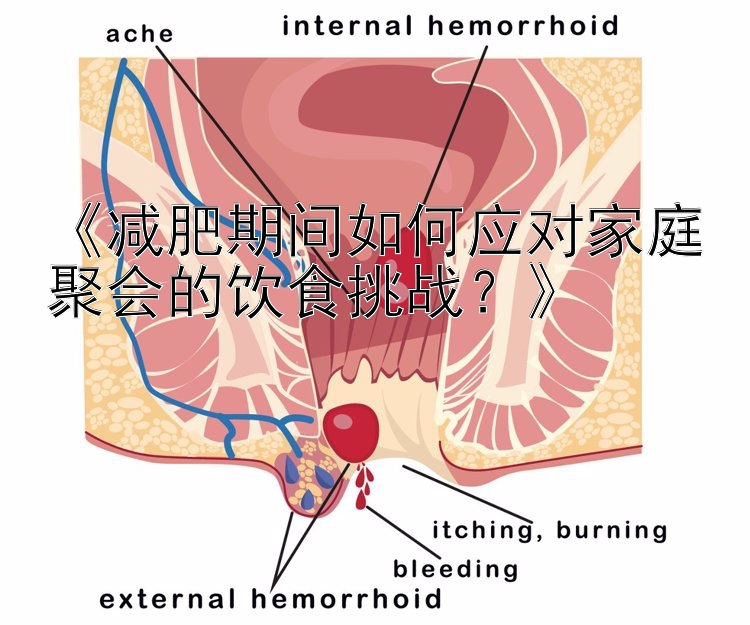 《减肥期间如何应对家庭聚会的饮食挑战？》