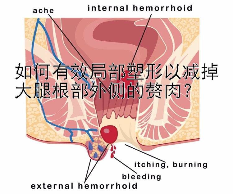 如何有效局部塑形以减掉大腿根部外侧的赘肉？