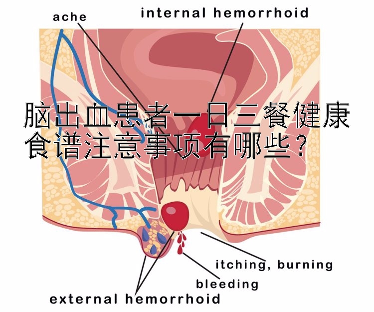 脑出血患者一日三餐健康食谱注意事项有哪些？